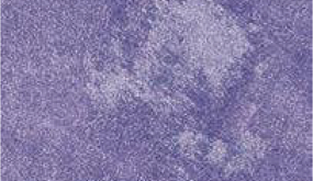 Brilliant Blue
