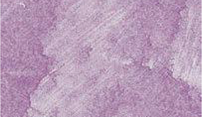 Purple Heart