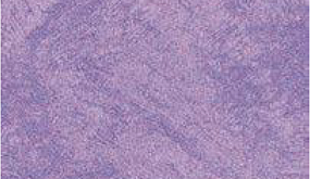 Ultra Violet